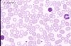 Diapositives - sang normal
